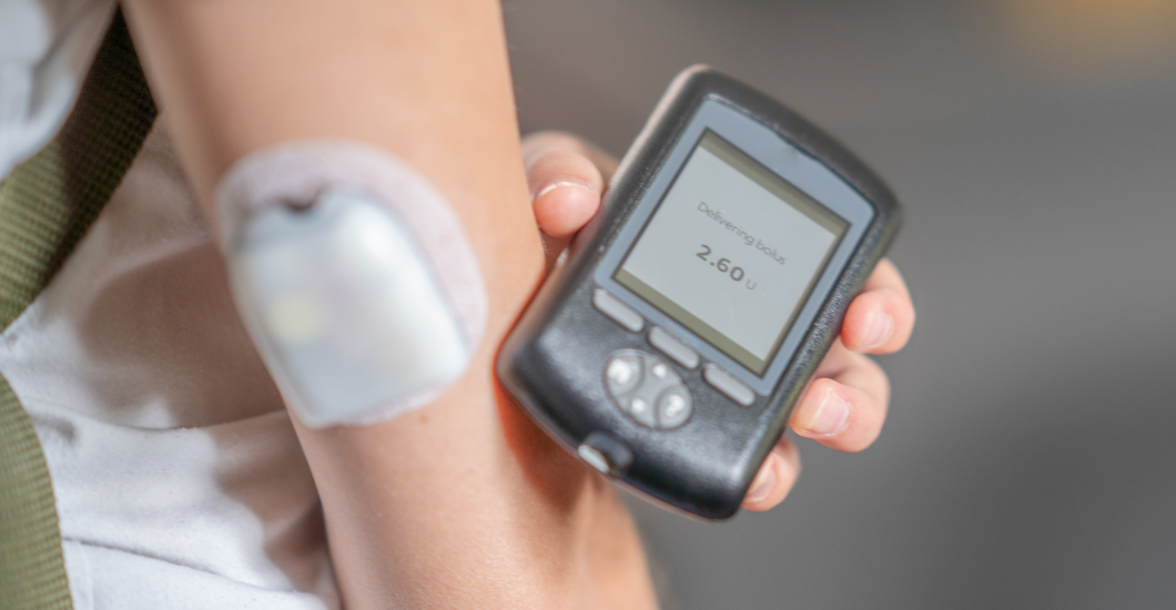Beyond blood sugar: understanding the nuances